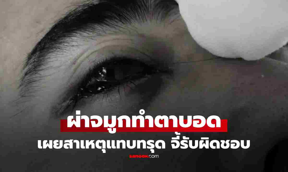 หนุ่มผ่าตัด "ริดสีดวงจมูก" แต่กลับ "ตาบอด" ย้ายตรวจอีกรพ. รู้สาเหตุทำเอาแทบช็อก!