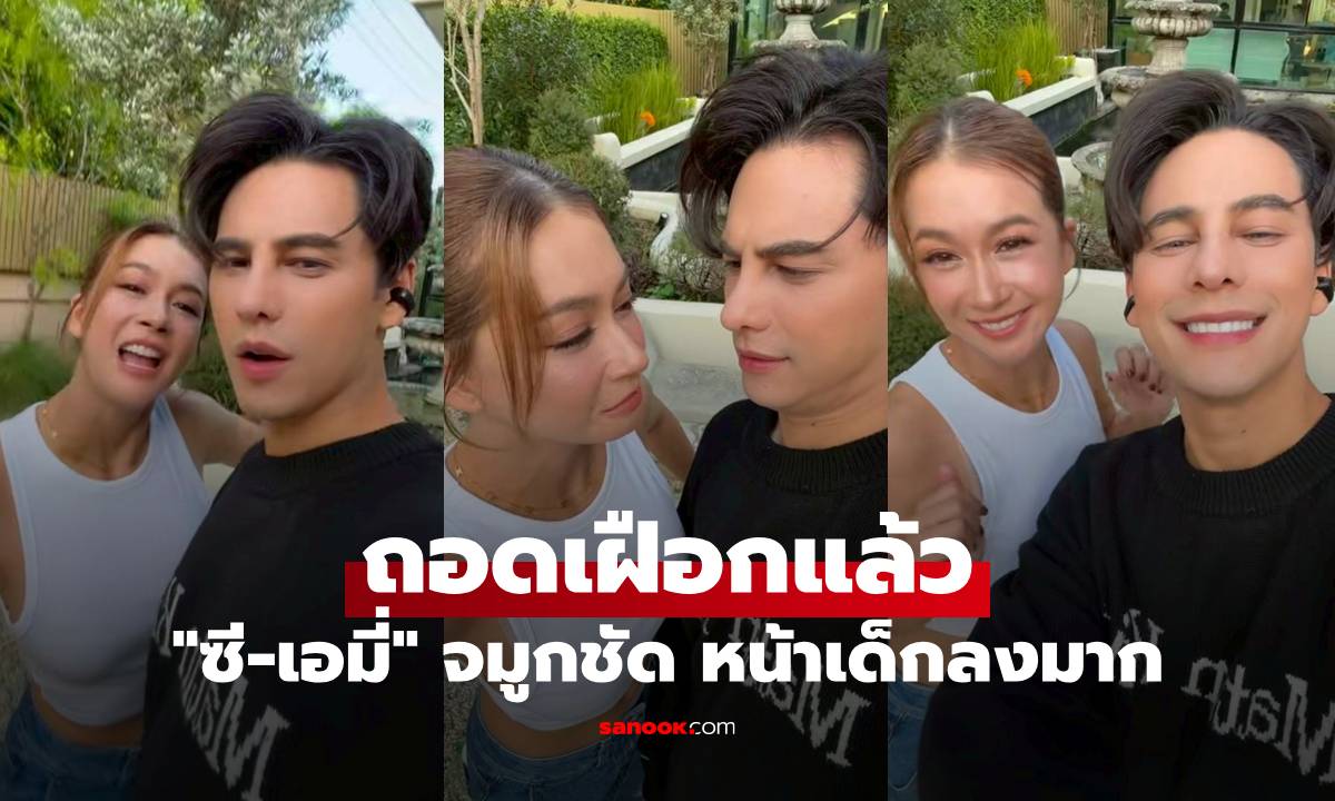 "ซี-เอมี่" ถอดเฝือกแล้ว ศัลยกรรมแพ็กคู่ จมูกชัด หน้าเด็กลงมาก