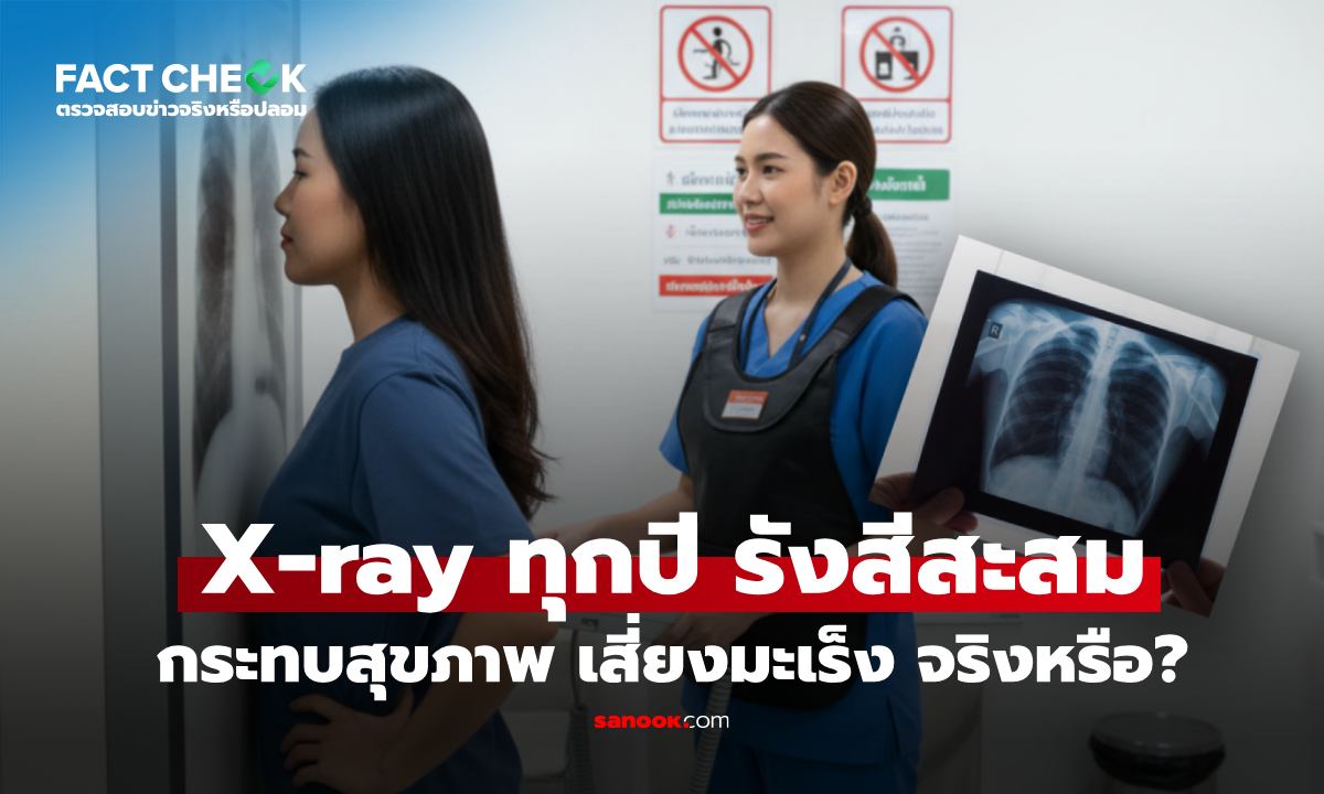 เช็กข่าวชัวร์ : เอ็กซเรย์ปอดทุกปี "รังสีสะสม" เสี่ยงมะเร็ง จริงหรือ? เทียบชัดๆ แค่ไหนเสี่ยง