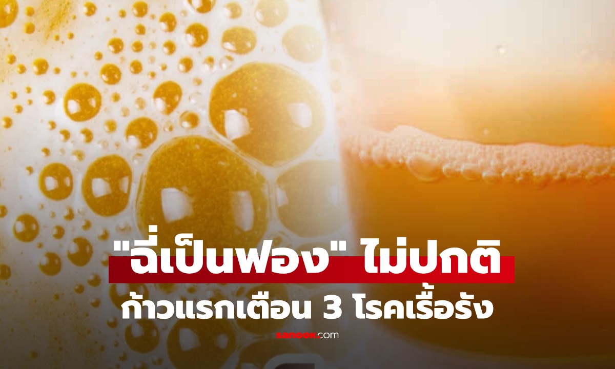 "ฉี่เป็นฟอง" ไม่ปกติ! หากมีลักษณะแบบนี้ เสี่ยง 3 โรคเรื้อรัง แต่คนส่วนใหญ่ไม่รู้