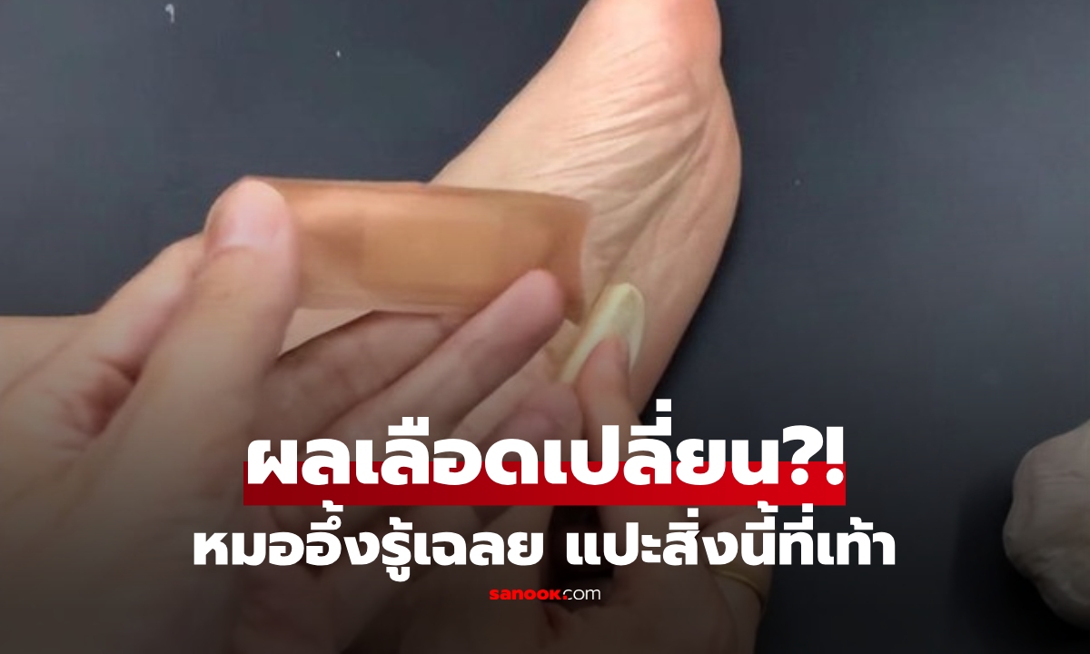 หมอถึงกับงง! หญิงวัย 56 ค่าเลือดเปลี่ยน เฉลยเคล็ดลับ "แปะสิ่งนี้" ที่ฝ่าเท้าทุกคืน 6 เดือน