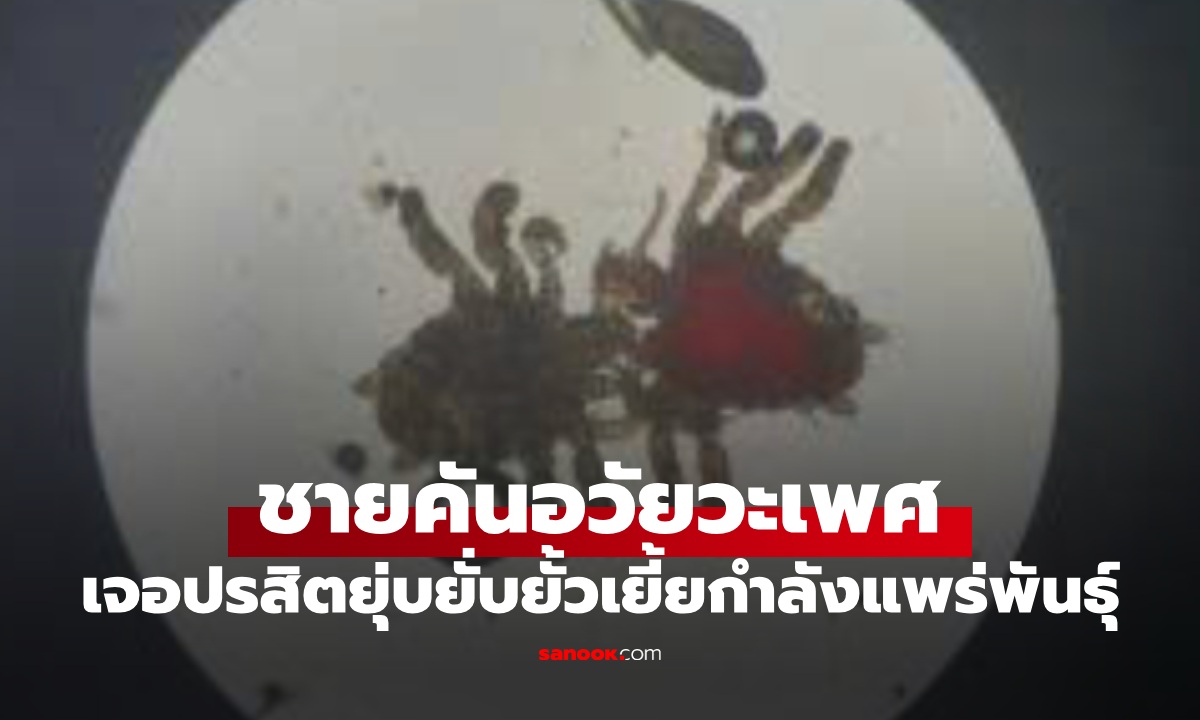 ชายคันเป้าเป็นปี หมอส่องกล้องเจอ "ปูจิ๋ว" กำลังจับคู่ผสมพันธุ์กันอยู่ในอวัยวะเพศคน