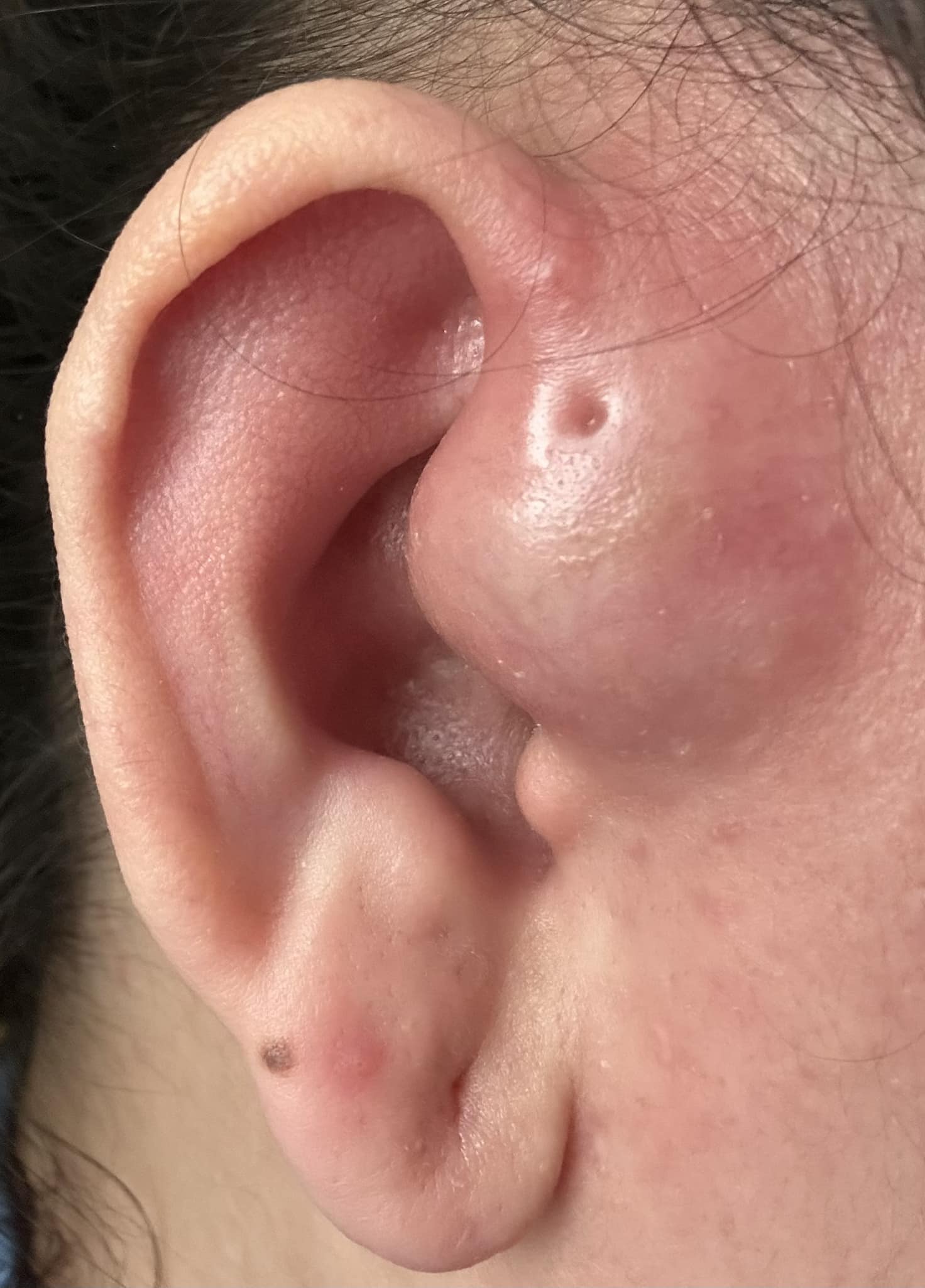 515683305_24525932007003904_4