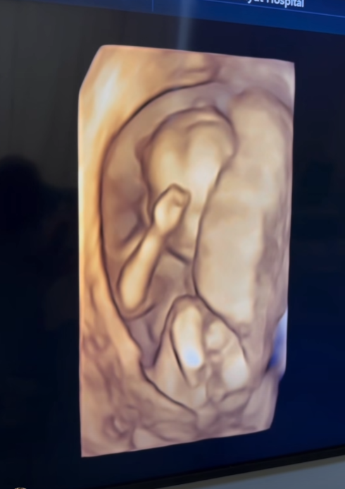 ครูก้อย-เจมส์ เรืองศักดิ์