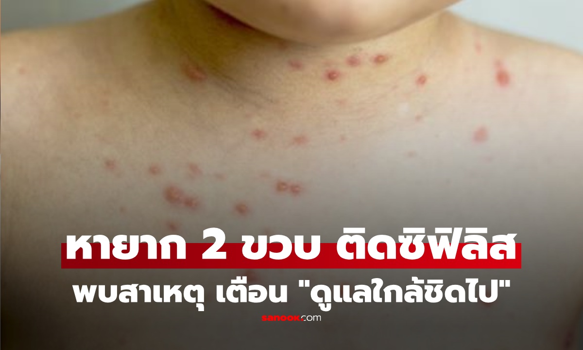 อึ้ง 4 ขวบ ติดเชื้อ "ซิฟิลิส" พบสาเหตุ ที่แท้วิธีการดูแลของครอบครัว "ใกล้ชิดเกินไป"