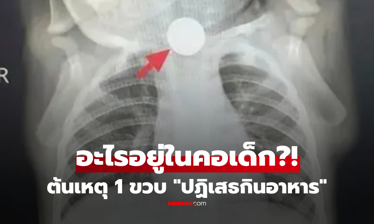 "ฉันทำหลานเอง" ย่าเข่าทรุด รู้สาเหตุที่หลาน 1 ขวบ "ไม่กินข้าว" นาน 7 วัน ถึงกับปล่อยโฮ