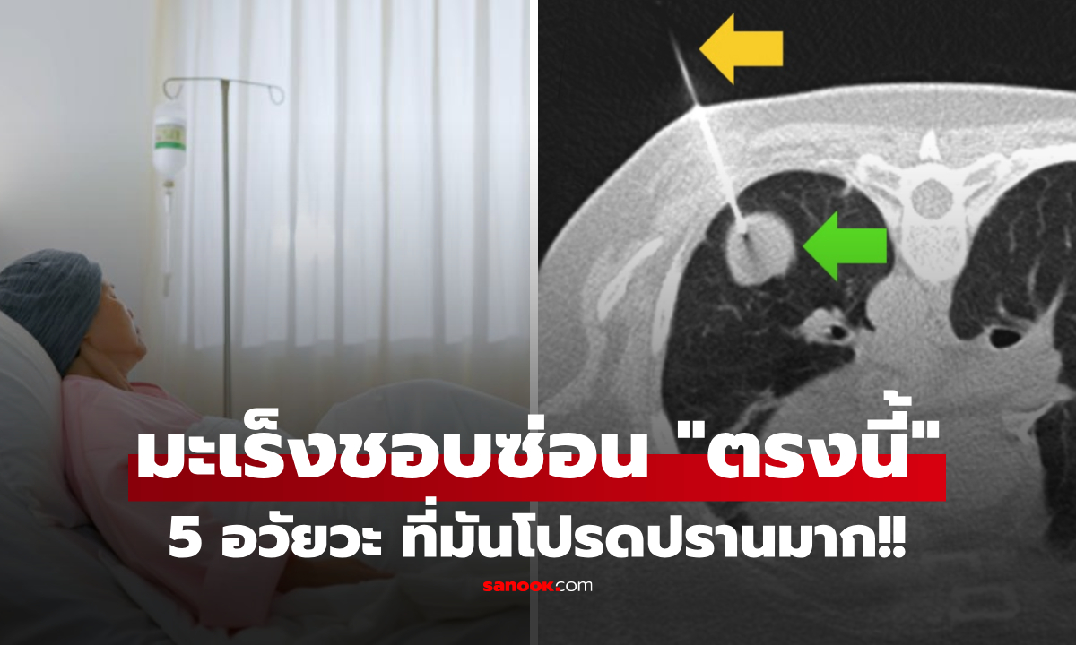 เช็กด่วน! 5 อวัยวะที่เซลล์มะเร็ง "โปรดปราน" ซ่อนเก่งจนหาไม่เจอ รู้อีกทีก็ลามหนัก