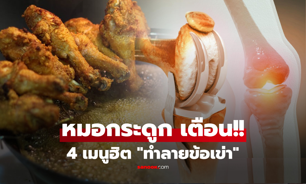 ระวัง!! เดินไม่ได้ตอนแก่ หมอกระดูกเตือน 4 อาหาร "กัดกินข้อเข่า" พังไวที่สุด