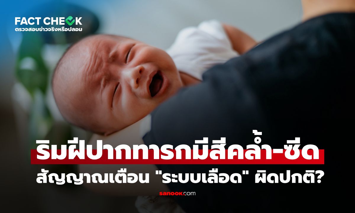 ริมฝีปากทารกมีสีคล้ำ-ซีด เป็นสัญญาณเตือน "ระบบเลือด" ผิดปกติ? : เช็กข่าวชัวร์