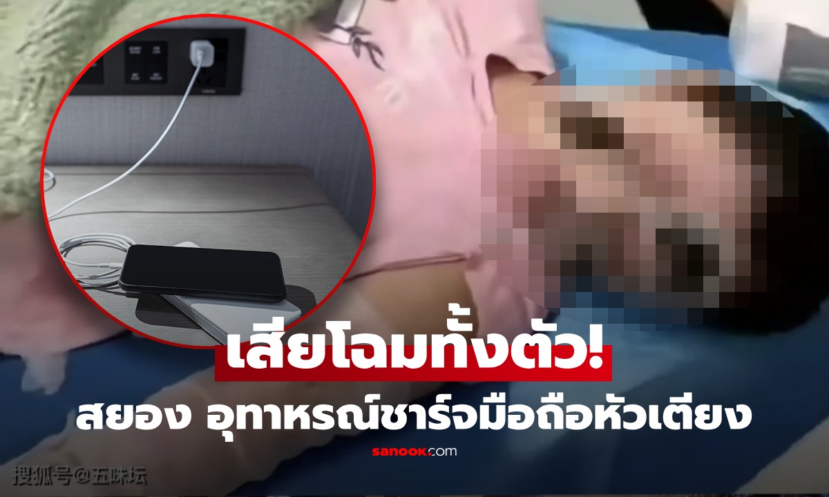 ใครทำอยู่เลิกซะ! อุทาหรณ์ ชาร์จมือถือข้ามคืน ไว้ใกล้หมอน ตื่นมาเสียโฉมหนักทั้งตัวกว่า 70%