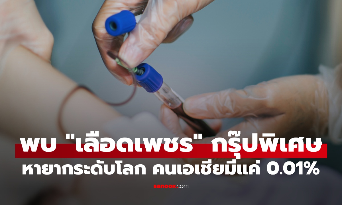 พบ "เลือดเพชร" กรุ๊ปพิเศษ Jk(a-b-) หายากระดับโลก คนเอเชียมีแค่ 0.01%