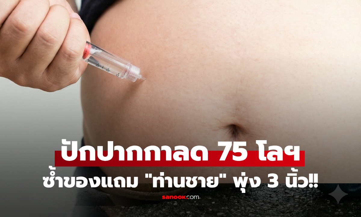 ลดน้ำหนักได้ของแถม! หนุ่มปักปากกา ลดกว่า 75 กก. อึ้ง ผลข้างเคียงอวัยวะเพศดูยาวขึ้น 3 นิ้ว