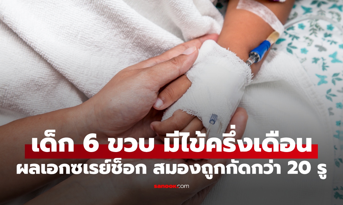 เด็กหญิง 6 ขวบ ไข้สูงไม่ลดครึ่งเดือน ผลเอกซเรย์ช็อก สมองถูกกัดเป็นรูกว่า 20 จุด