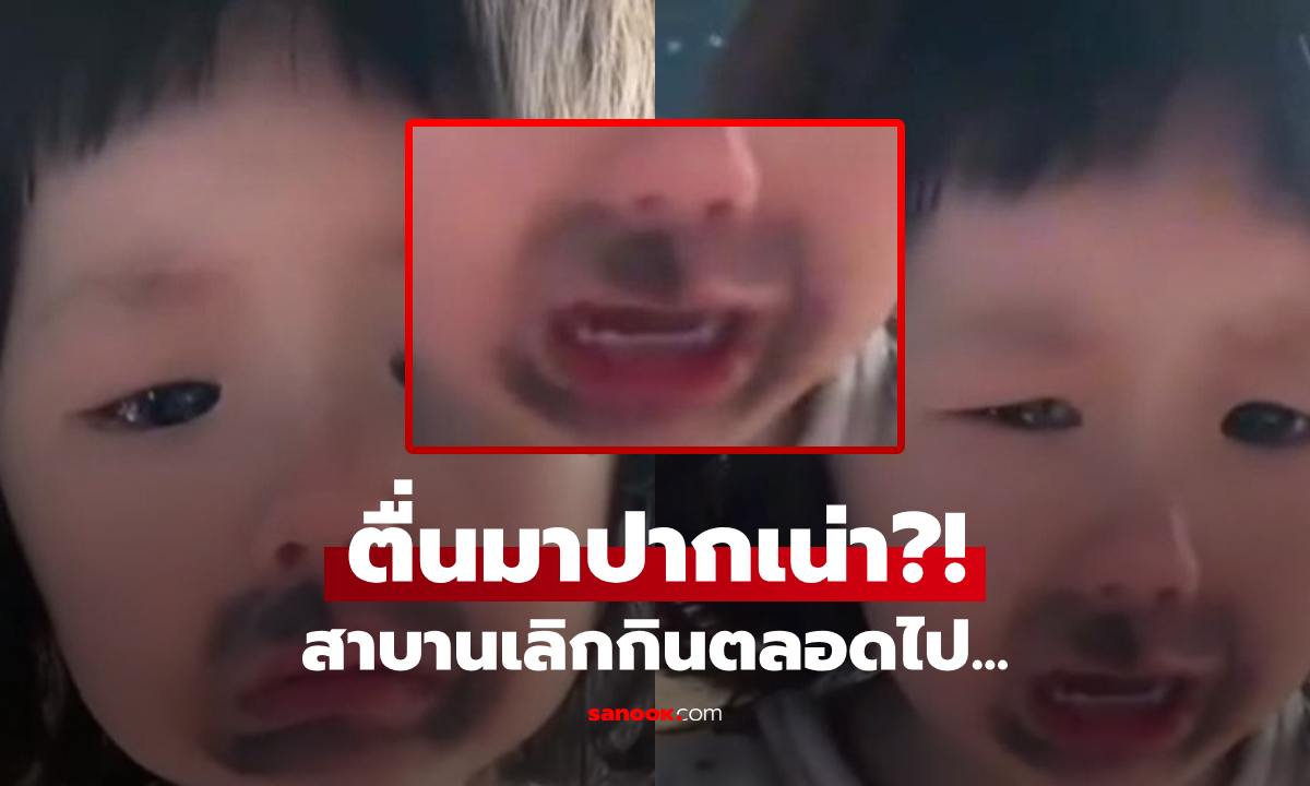 ตื่นมาปากเน่า! แม่แก้เผ็ดลูกสาว "แอบกินขนม" ส่องกระจกร้องจ๊าก สาบานเลิกกินตลอดชีวิต