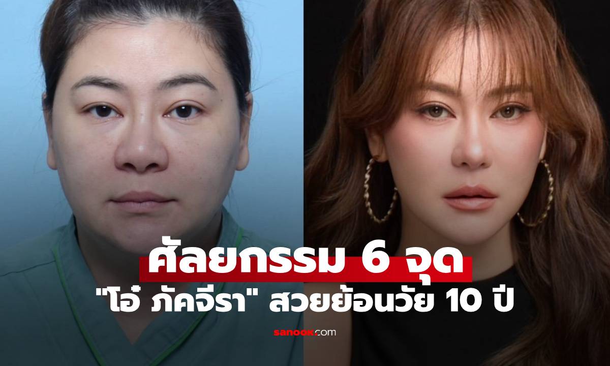 เปิดภาพ "โอ๋ ภัคจีรา" ศัลยกรรม 6 จุด สวยย้อนวัย 10 ปี