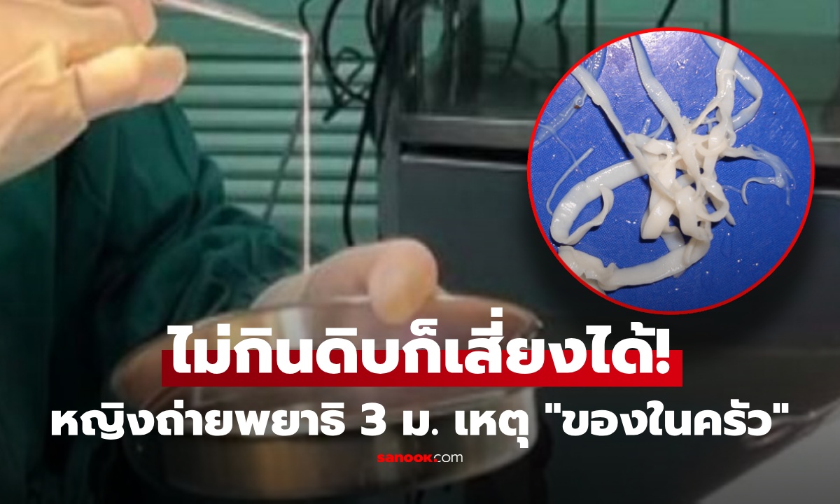 ช็อก! หญิงถ่าย "พยาธิ" ยาว 3 เมตร แม้ไม่กินดิบ แพทย์หาสาเหตุ ที่แท้ "ของในครัว" เสี่ยงกันทุกบ้าน