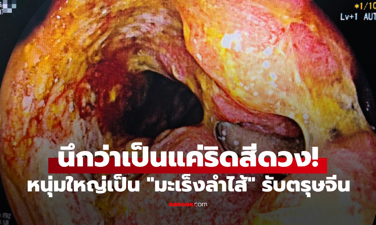 นึกว่าเป็นแค่ริดสีดวง! หนุ่มใหญ่อึ้งเป็น "มะเร็งลำไส้" พูดประโยคเดียวทำหมอน้ำตาซึม