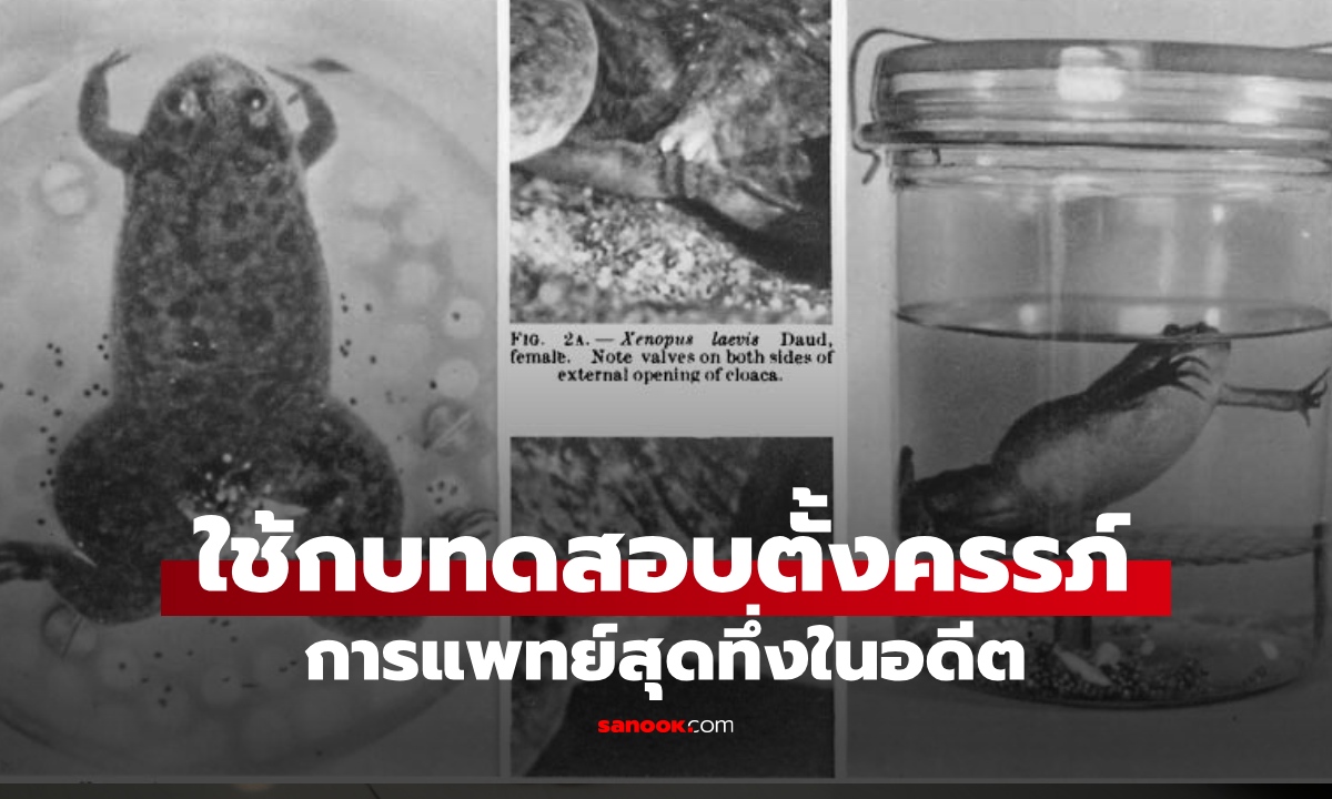 แพทย์สมัยก่อนใช้ "กบ" ตัวเป็นๆ ทดสอบการตั้งครรภ์ของมนุษย์ บอกผลลัพธ์แม่นยำ