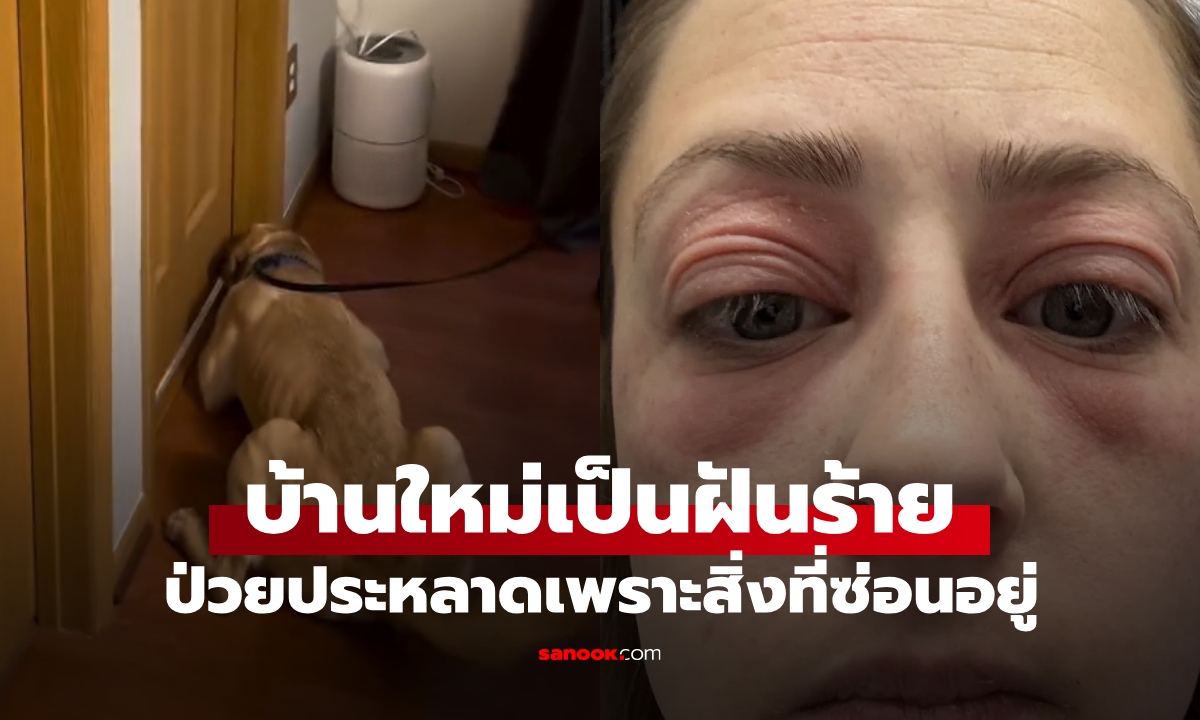 สาวซื้อบ้าน 13 ล้าน ย้ายเข้าไม่กี่เดือน ป่วยประหลาดเสียโฉม เพชฌฆาตเงียบแฝงตัวทุกอณู