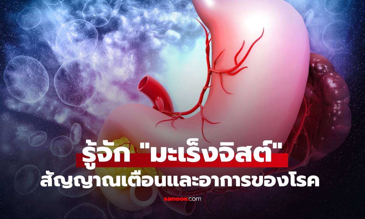 รู้จัก "โรคมะเร็งจิสต์" เกิดจากอะไร? สัญญาณเตือนและอาการที่ควรเฝ้าระวัง