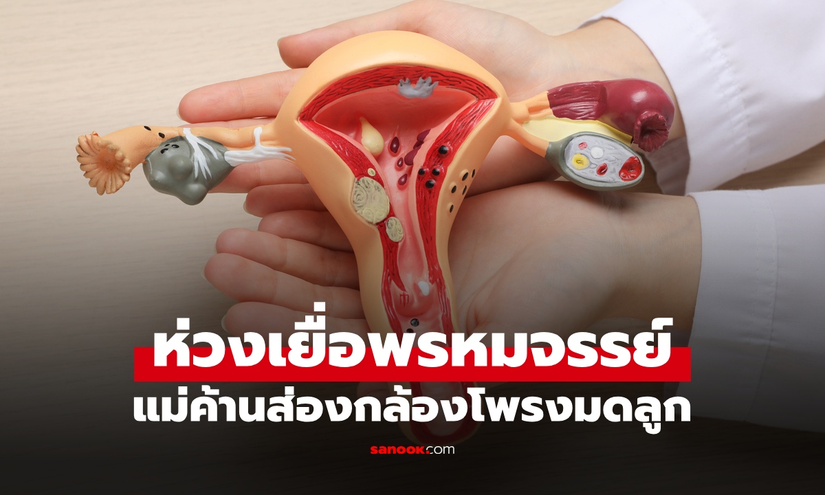 หมออึ้ง สาววัย 20 มีติ่งเนื้อในโพรงมดลูก แม่ไม่ให้ส่องกล้องผ่า บอกลูกยังไม่เคยมีแฟน