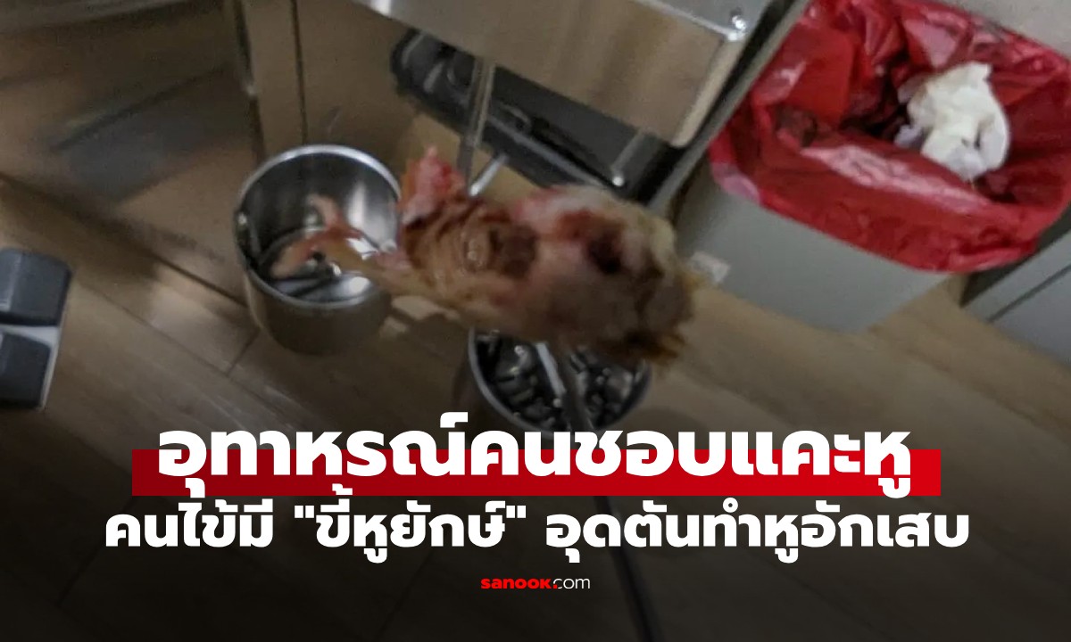 หยุดแคะหู! หมอแชร์ภาพ 