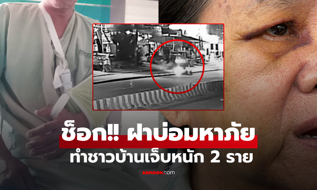 เปิดนาที "ฝาบ่อ" สยอง! ทำชาวบ้านเจ็บหนัก 2 ราย ชายไหปลาร้าหัก-ยายกระดูกหน้าร้าว