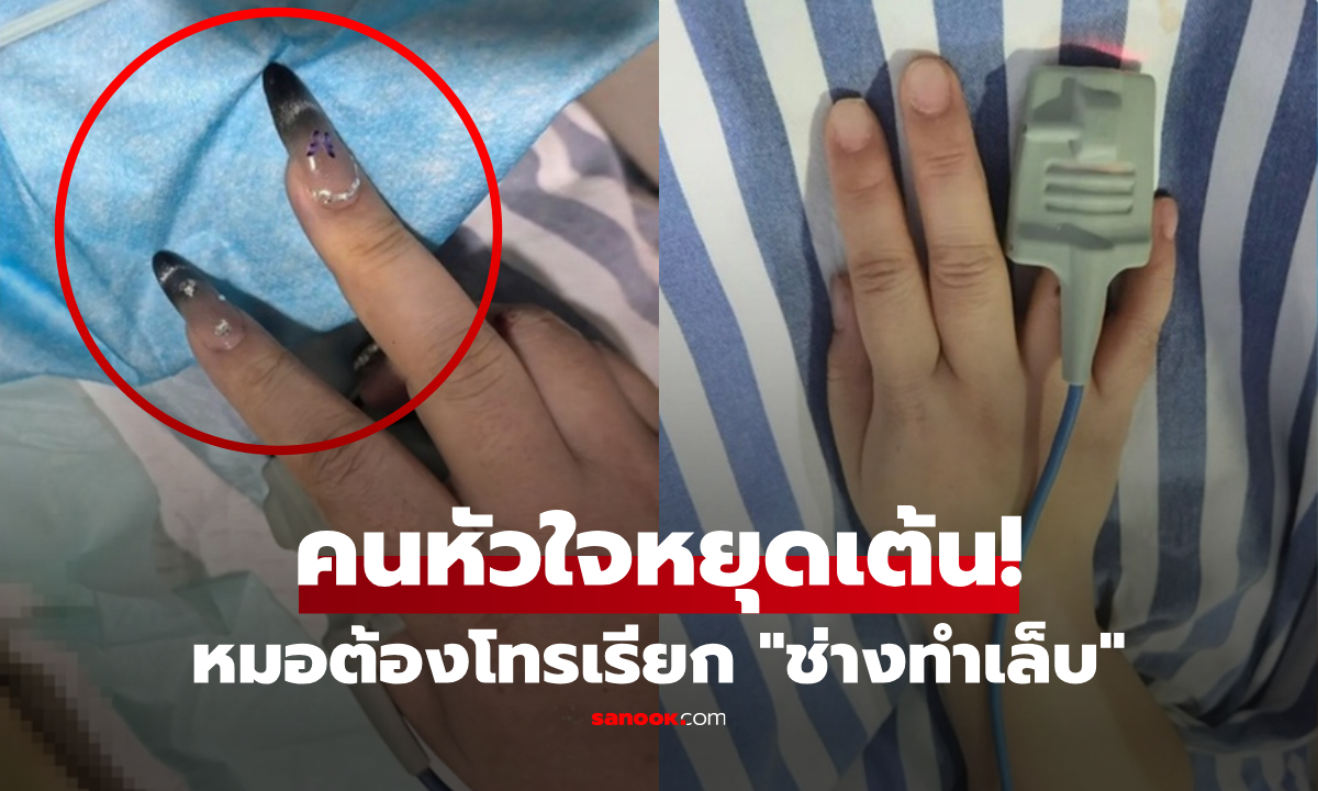 คนไข้หัวใจหยุดเต้น แพทย์รีบโทรเรียก "ช่างทำเล็บ" มาช่วยในห้องฉุกเฉิน เหตุผลทำคนอึ้ง!!