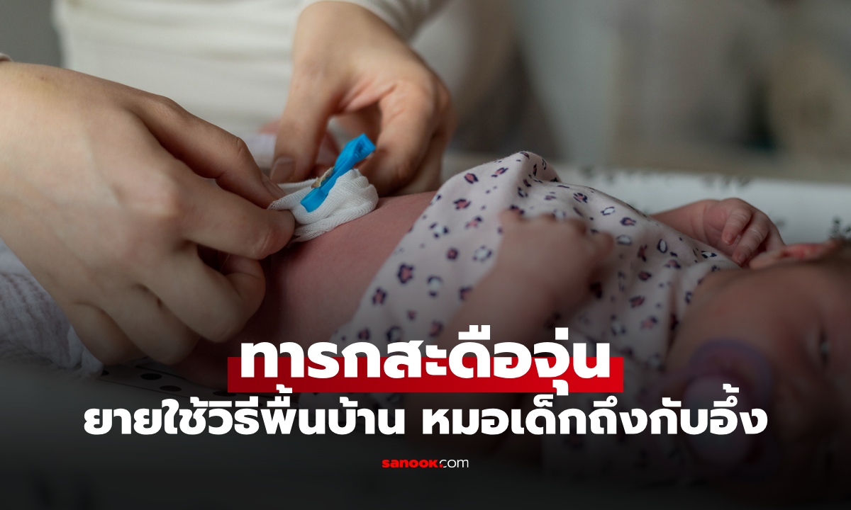 ทารก "สะดือจุ่น" ยายรักษาด้วยวิธีพื้นบ้าน กุมารแพทย์เห็นแล้วอึ้ง นี่มันปี 2026 แล้ว!