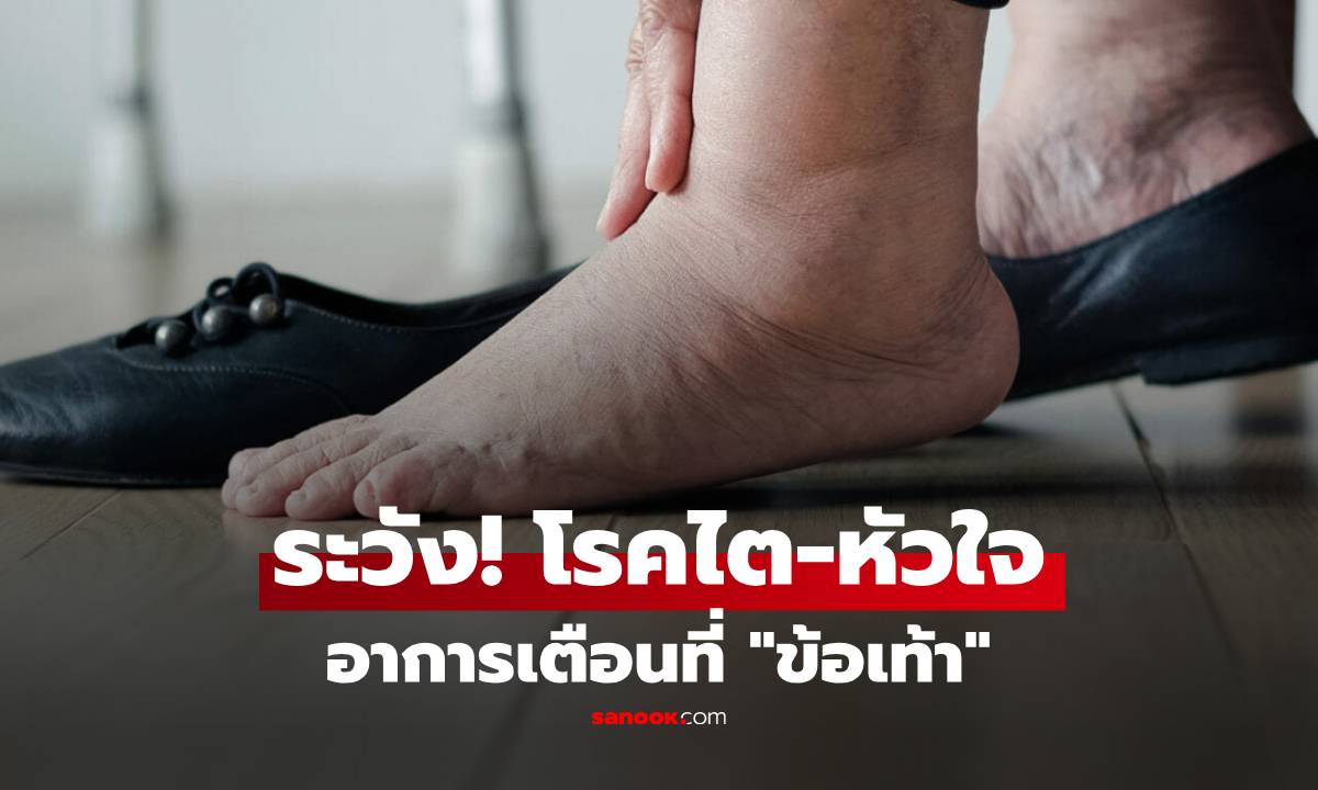 โปรดระวัง “ข้อเท้า” กับสัญญาณเตือนโรคไต-หัวใจ ที่ร่างกายกำลังตะโกนบอก!!!