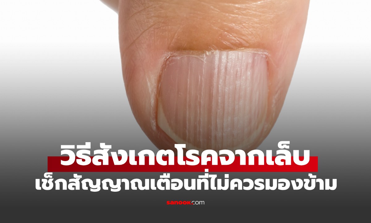 เล็บเป็นคลื่นบอกอะไร? วิธีสังเกตโรคจากเล็บ สัญญาณเตือนที่แม่นจนน่าตกใจ!