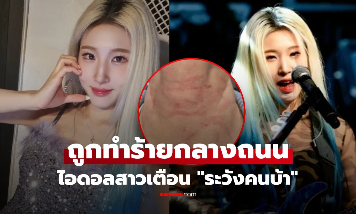 แฟนคลับช็อก! ไอดอลสาวเกาหลี ถูกทำร้ายกลางถนน แผลเต็มหน้า-คอ ก่อนโพสต์ "ระวังคนบ้ากันด้วย"