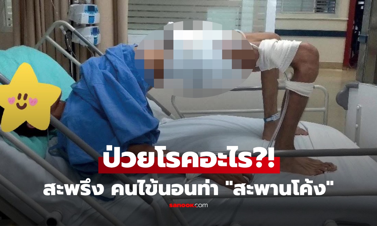 โรคอะไร? ภาพชวนขนลุก คนไข้นอนหลังแอ่น "ท่าสะพานโค้ง" หมอเฉลยป่วยอะไร ยันไม่ใช่สิ่งลี้ลับ!