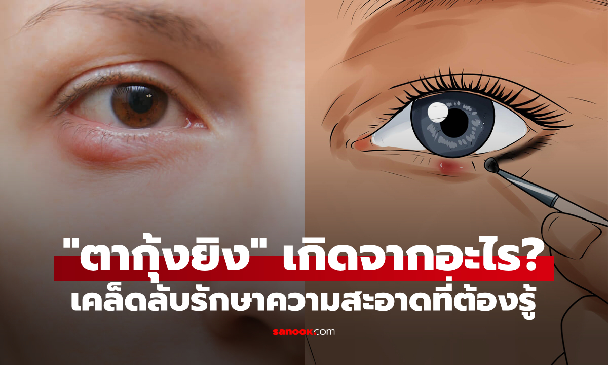 "ตากุ้งยิง" เกิดจากอะไร? เคล็ดลับรักษาความสะอาดที่สายแต่งหน้าต้องรู้