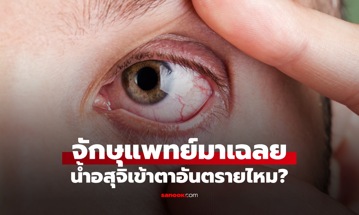 ไขข้อสงสัย! อสุจิเข้าตาจะเห็น "ลูกอ๊อด" ว่ายไปมาไหม? หมอเฉลยจุดจบสุดพีค