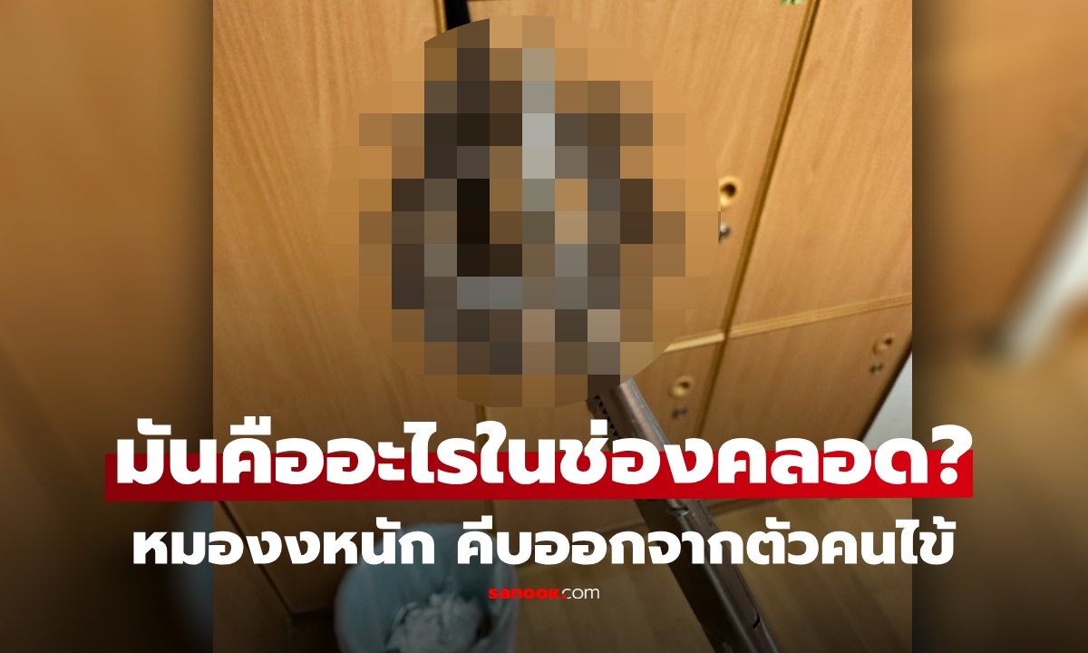 หมอ งง! พบ "วัตถุปริศนาขนพรึ่บ" ในช่องคลอด คนไข้เขินไม่บอก ไปถามในเน็ต รู้ความจริง ขนลุกเลย