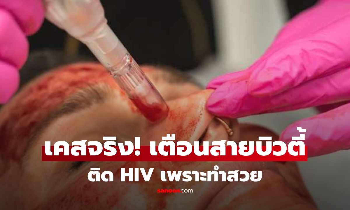 อยู่ยากมาก! หญิง 3 ราย ติด HIV ทั้งที่ไร้พฤติกรรมเสี่ยง อึ้ง พบต้นเหตุ จาก "ทำสวย"
