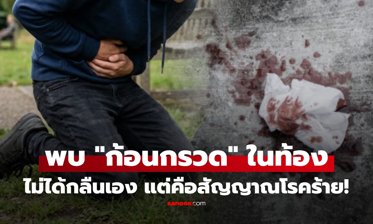 เด็ก 15 อ้วกเป็นเลือด พบเหมือน "ก้อนกรวด" เต็มท้อง หมอเฉลยไม่ได้กลืนเอง แต่เป็นจุดเริ่มต้นโรคร้าย!