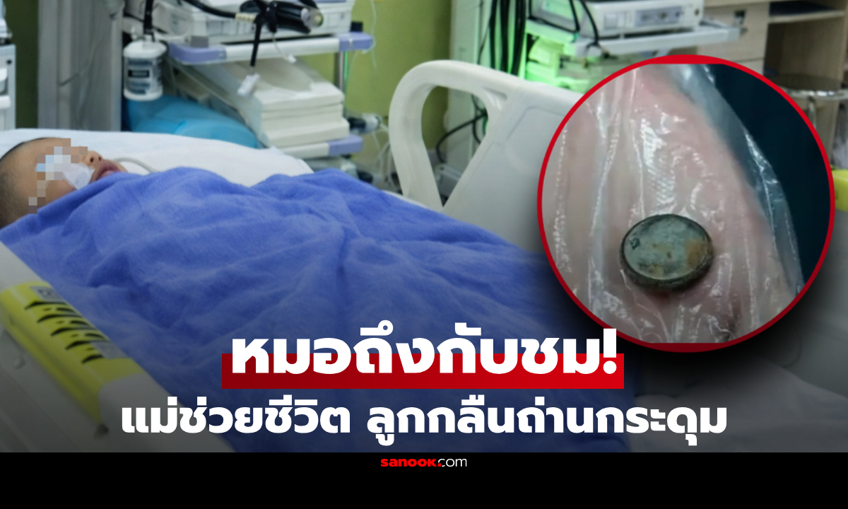 ชื่นชม! ลูก 3 ขวบ กลืนถ่านกระดุม แม่รีบให้กิน "สิ่งนี้" ตามไป 1 ช้อน ก่อนอุ้มส่งหมอ