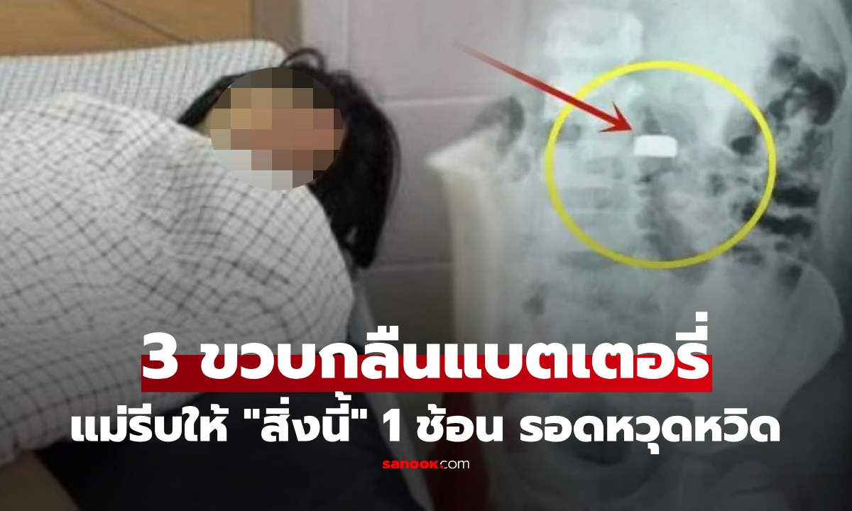 เด็ก 3 ขวบกลืนแบตเตอรี่กระดุม แม่รู้รีบให้กิน "สิ่งนี้" 1 ช้อนก่อนไปรพ. หมอชม ตัดสินใจได้ถูกมาก!