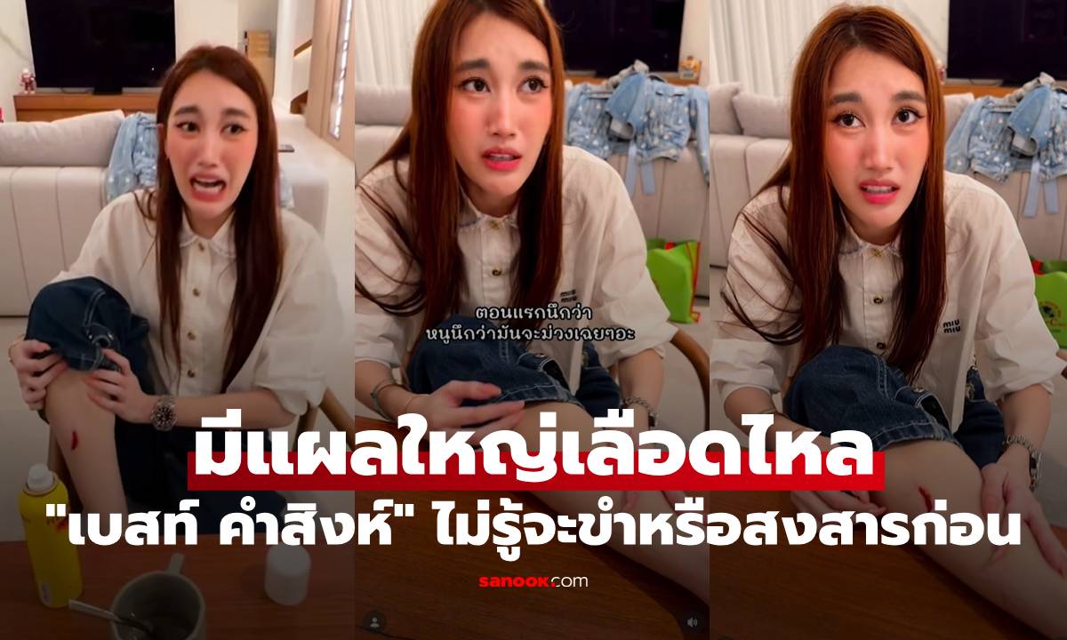 "เบสท์ คำสิงห์" ขาฟกช้ำ มีแผลใหญ่เลือดไหล รู้สาเหตุแล้วไม่รู้จะขำหรือสงสารก่อน