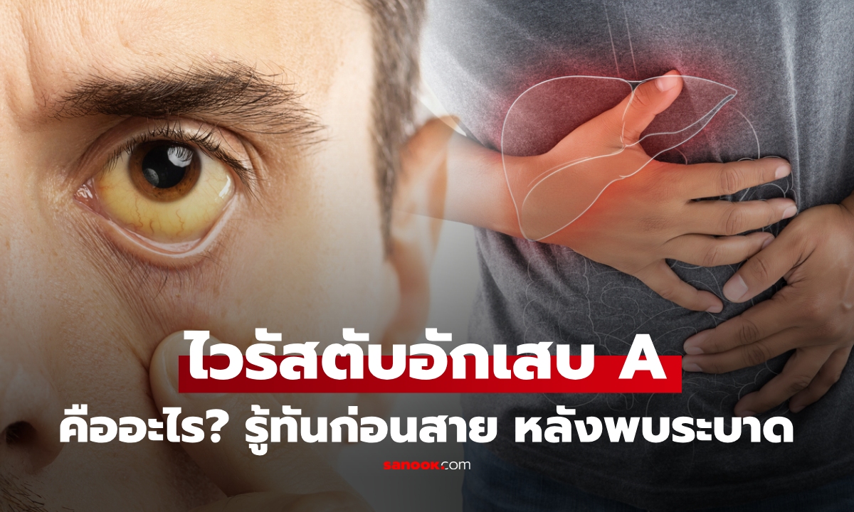 "ไวรัสตับอักเสบ A" คืออะไร รู้ทันอาการ อันตรายแค่ไหน? หลังพบคลัสเตอร์ไทย ป่วยพุ่ง 55 ราย