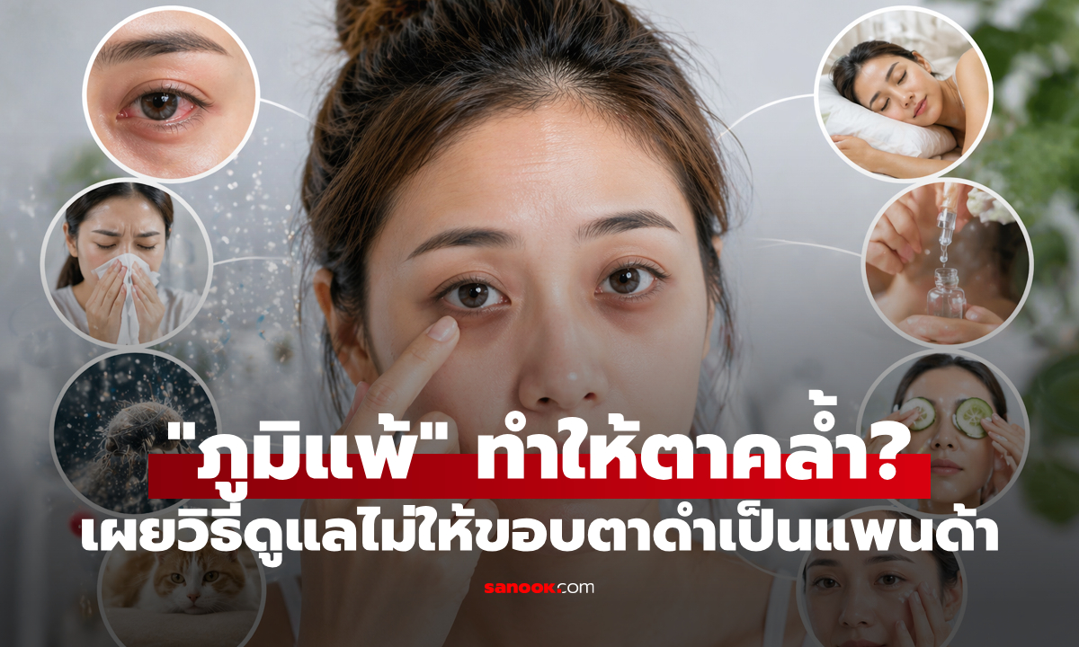 ขอบตาดำเป็นแพนด้า! “ภูมิแพ้ตา” ทำให้ตาคล้ำจริงหรือ? เผยวิธีดูแลรอบดวงตาให้กลับมาสดใส