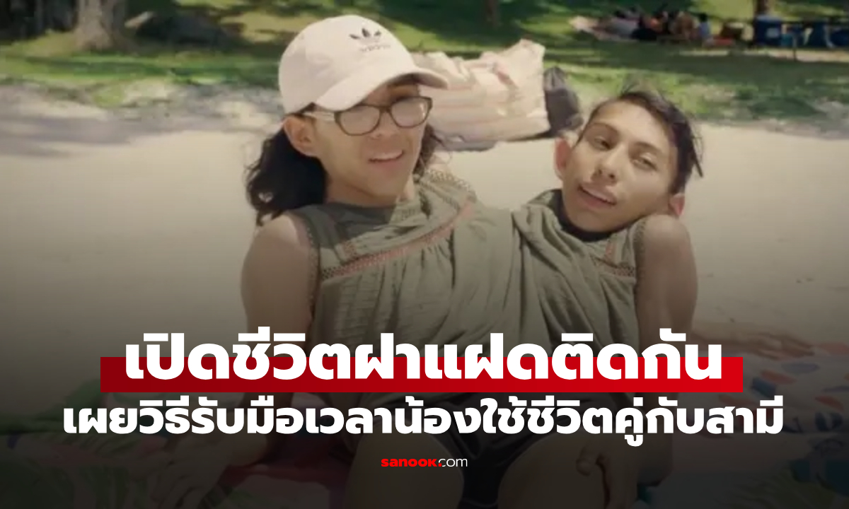 เปิดเบื้องหลังชีวิตคู่ "ฝาแฝดติดกัน" เมื่อหนึ่งคนมีสามี อีกคนต้องทำยังไง?