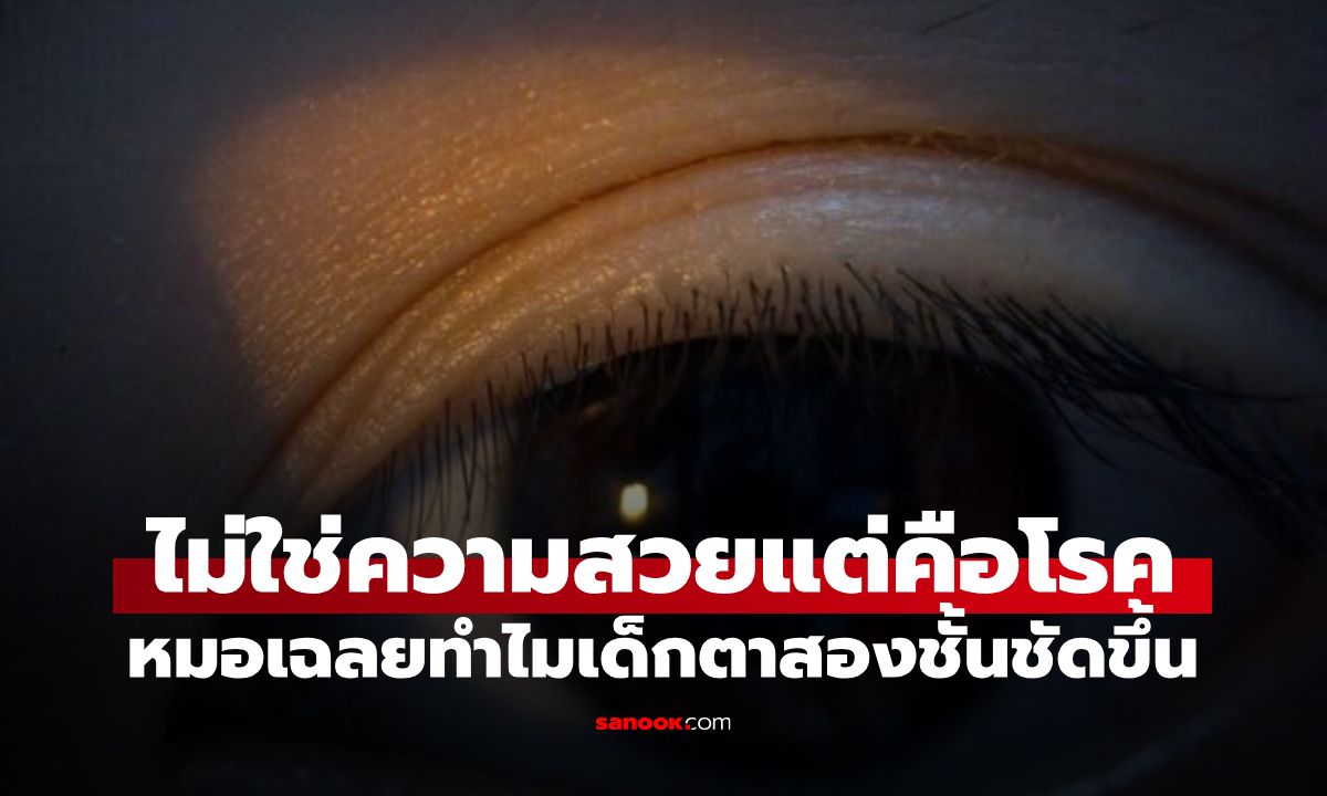 แม่ยิ้มกริ่ม! ลูกสาวตาสองชั้น "ลึกชัด" กว่าเดิม! แต่หมอเห็นแล้วส่ายหน้า นี่ไม่ใช่เรื่องดี