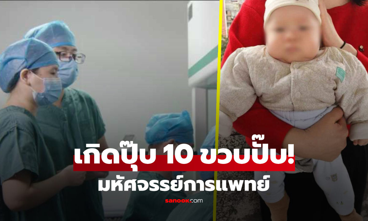เพิ่งเกิดแต่เป็น "พี่" อายุ 10 ขวบทันทีที่ลืมตาดูโลก แพทย์ชี้แข็งแรงสมบูรณ์อย่างปาฏิหาริย์