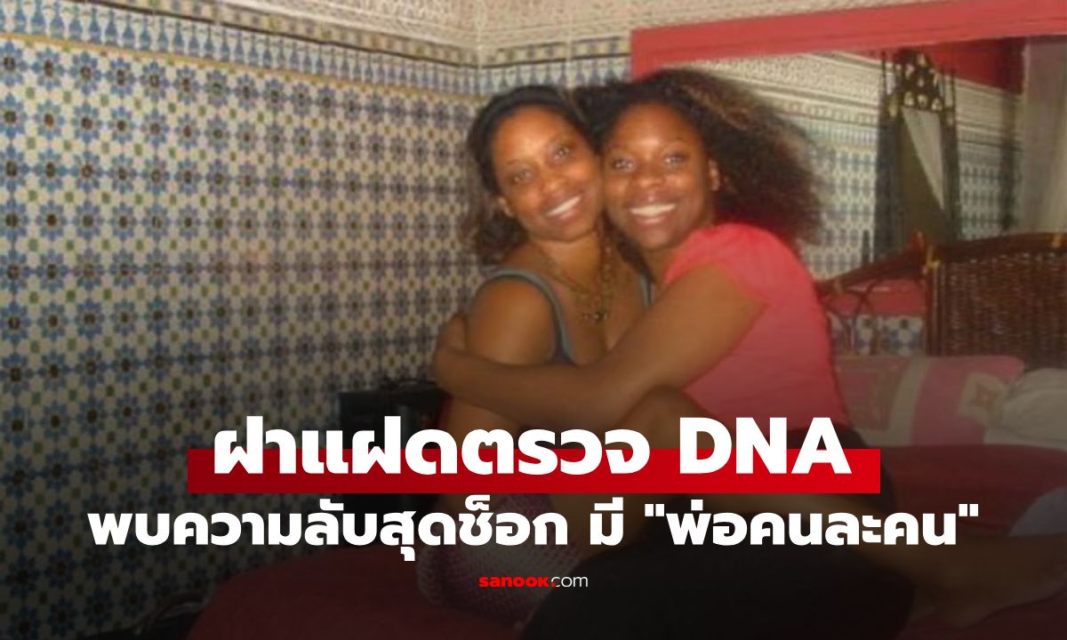 เคสหายาก 1 ในล้านของโลก! ฝาแฝดตรวจ DNA พบความลับสุดช็อก มี "พ่อคนละคน"