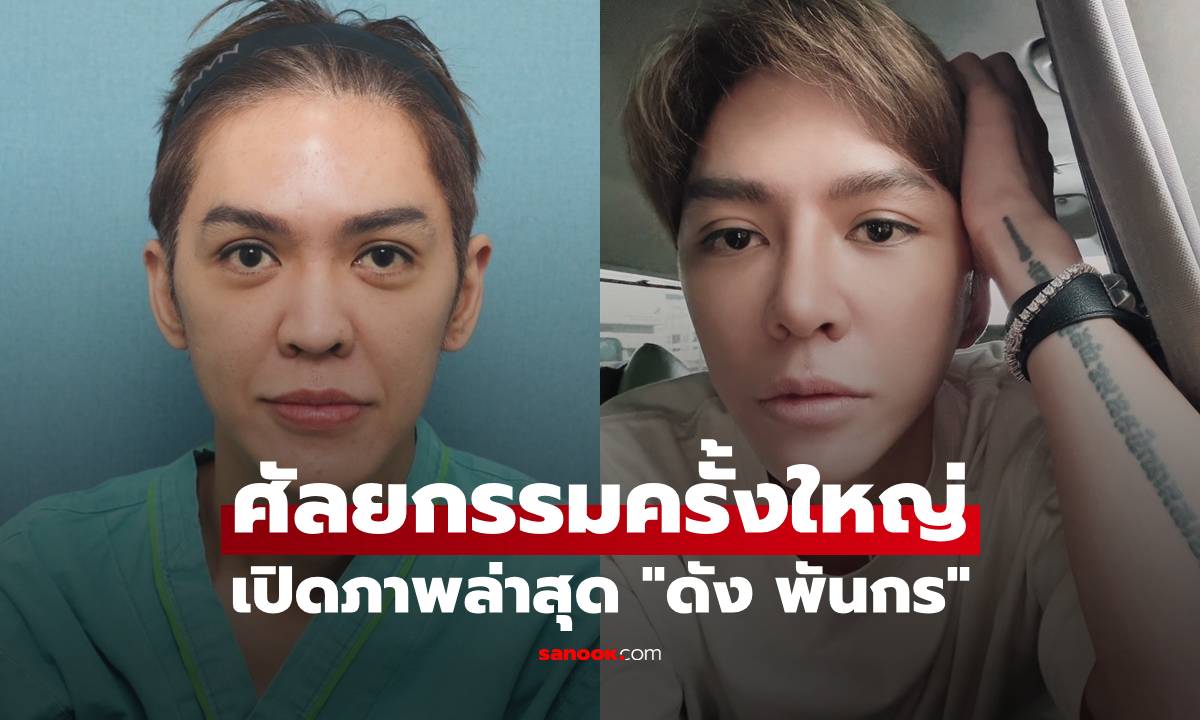 เปิดภาพล่าสุด "ดัง พันกร" ศัลยกรรมครั้งใหญ่ ออร่ามาเต็ม หน้าดูเด็กมาก