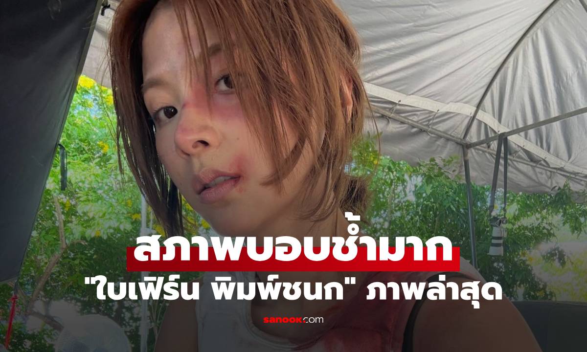 "ใบเฟิร์น พิมพ์ชนก" สภาพบอบช้ำมาก เผยภาพล่าสุด เห็นแล้วมีอึ้ง