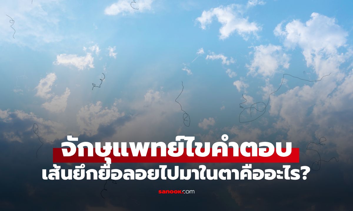 เส้นยึกยือลอยไปมาในตาคืออะไร? จักษุแพทย์ไขคำตอบ แบบไหนต้องรีบไปหาหมอ